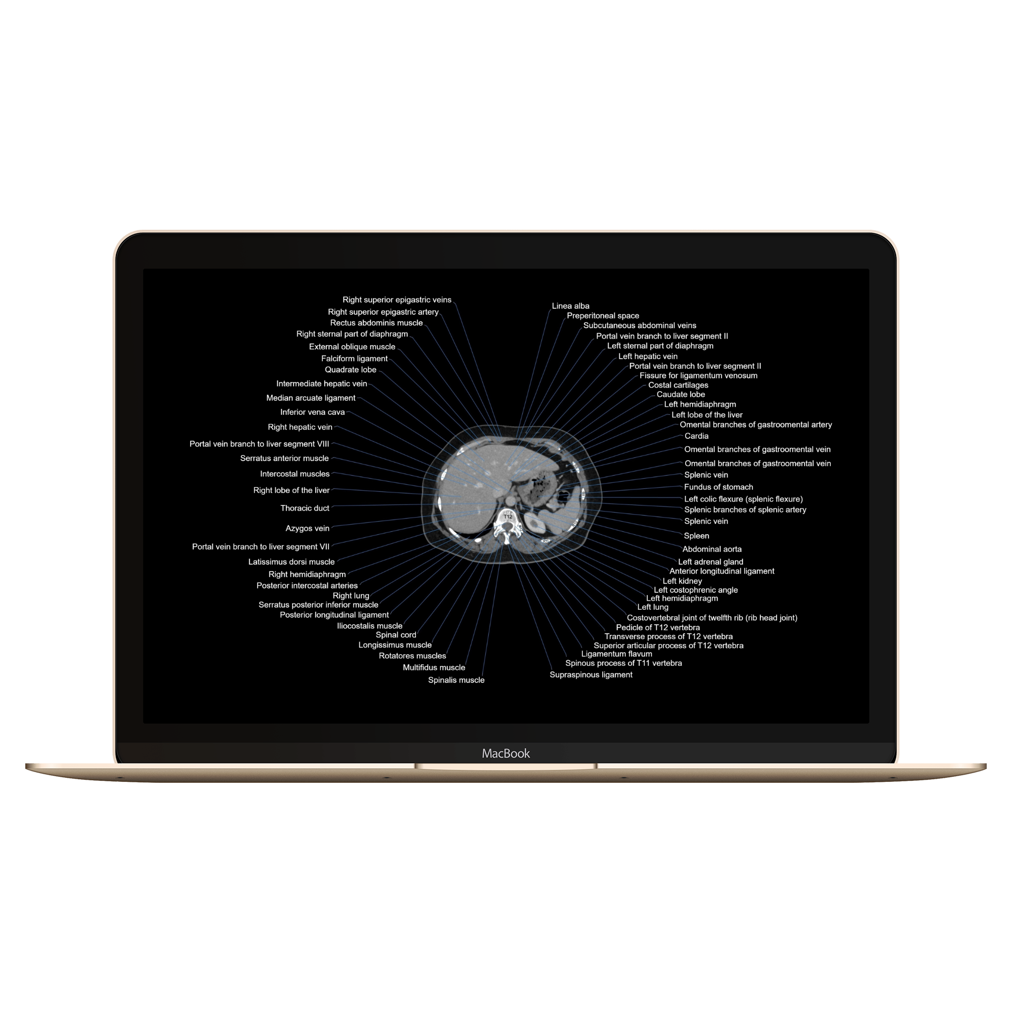 Welcome to CT Anatomy Atlas! (This website is under development.)