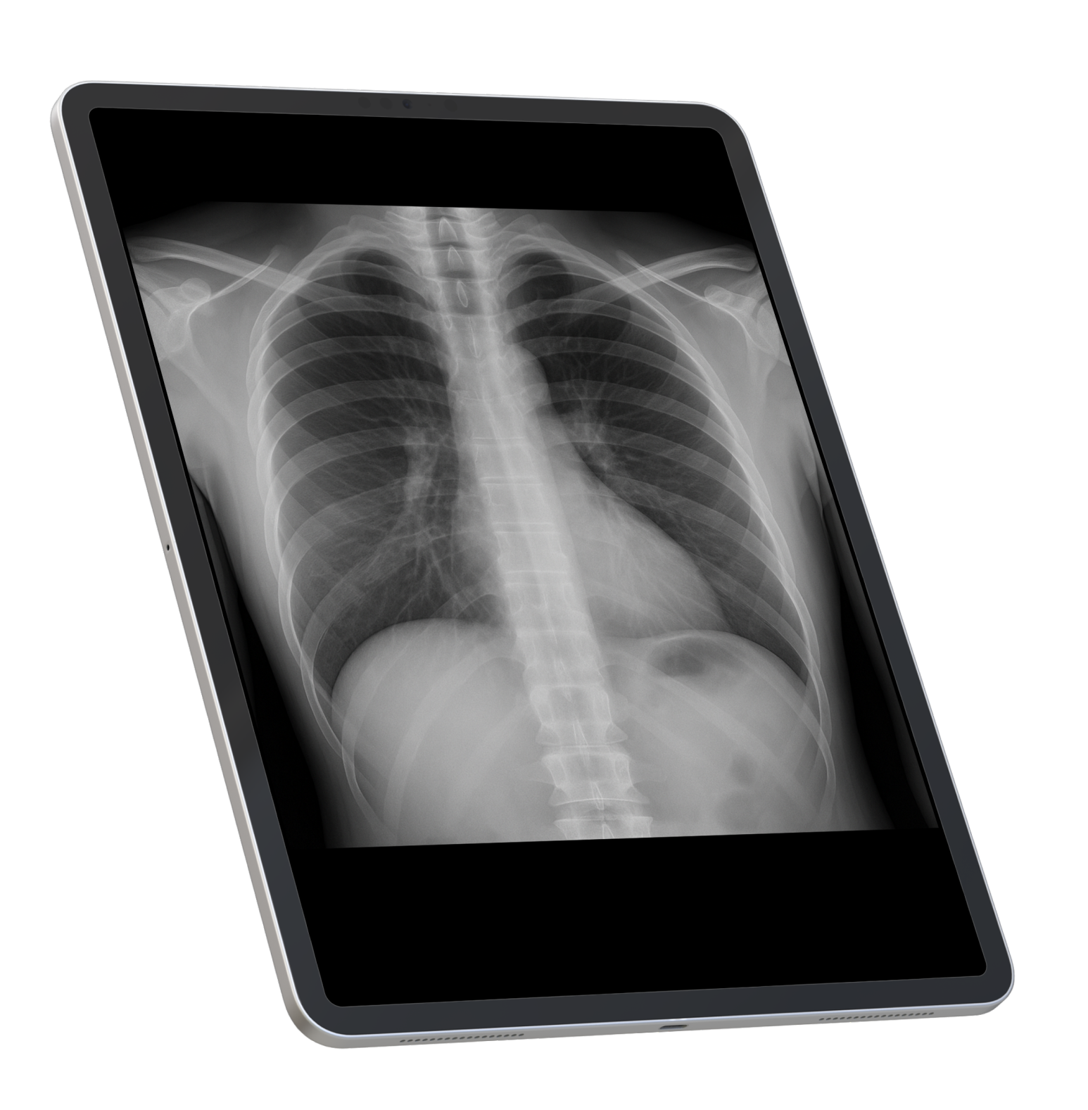 Welcome to X-Ray Anatomy Atlas!