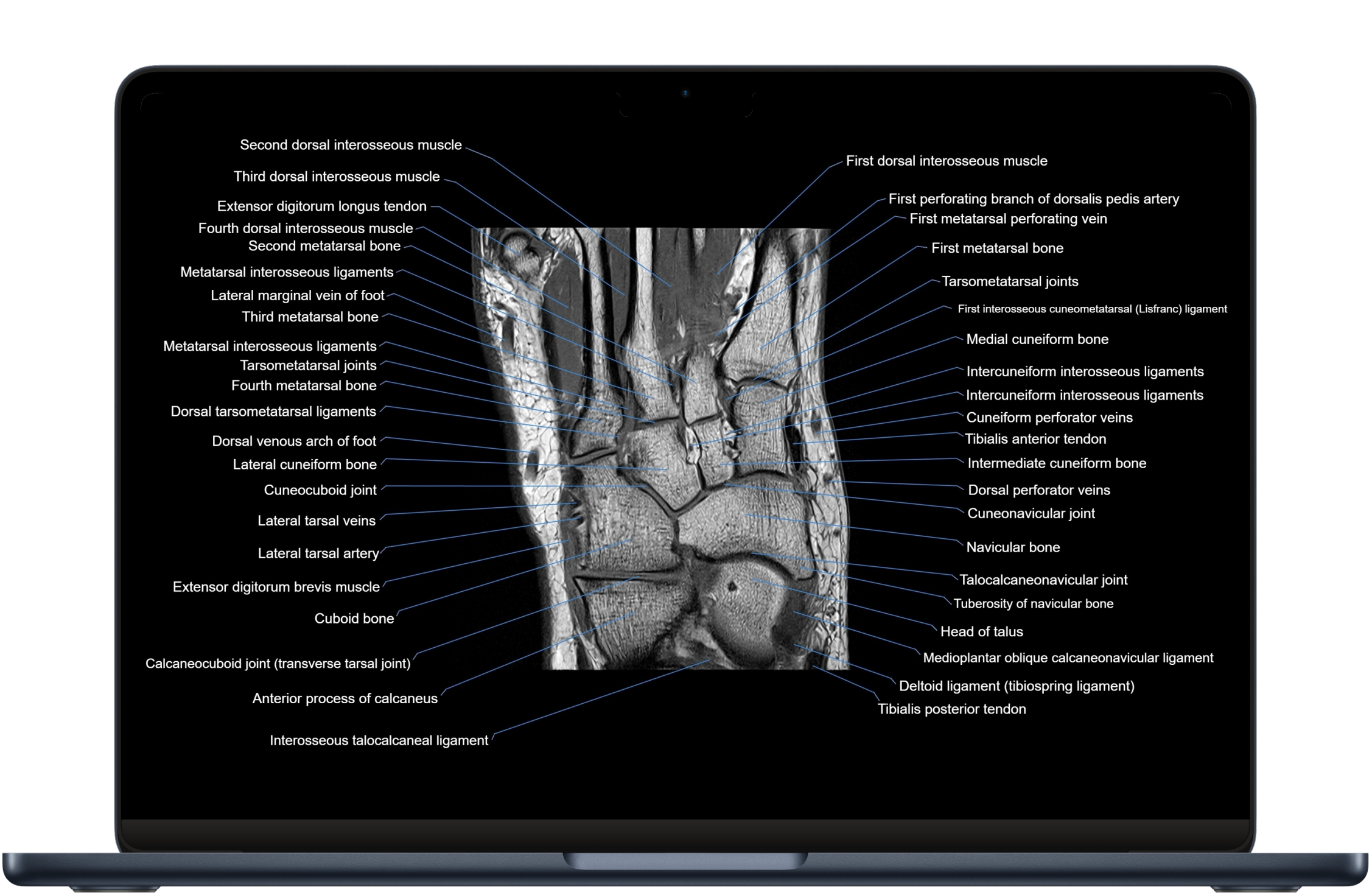 Welcome to MRI Anatomy Atlas! (This website is under development.)