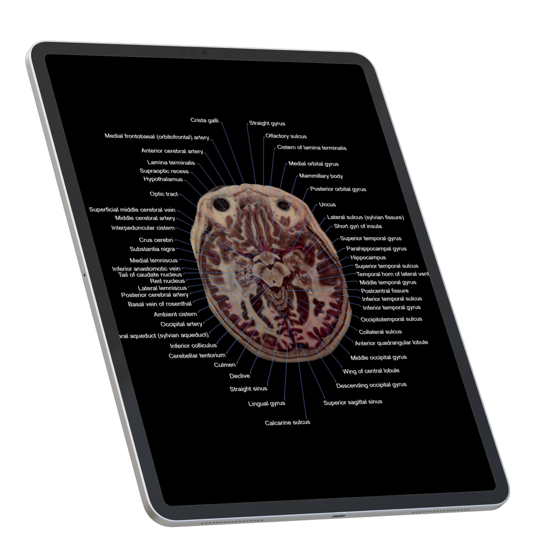 Welcome to Visible Human Anatomy Atlas!