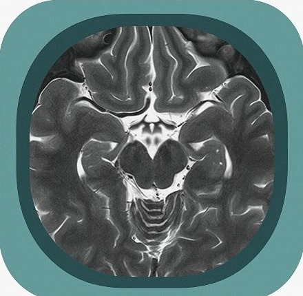 brain image